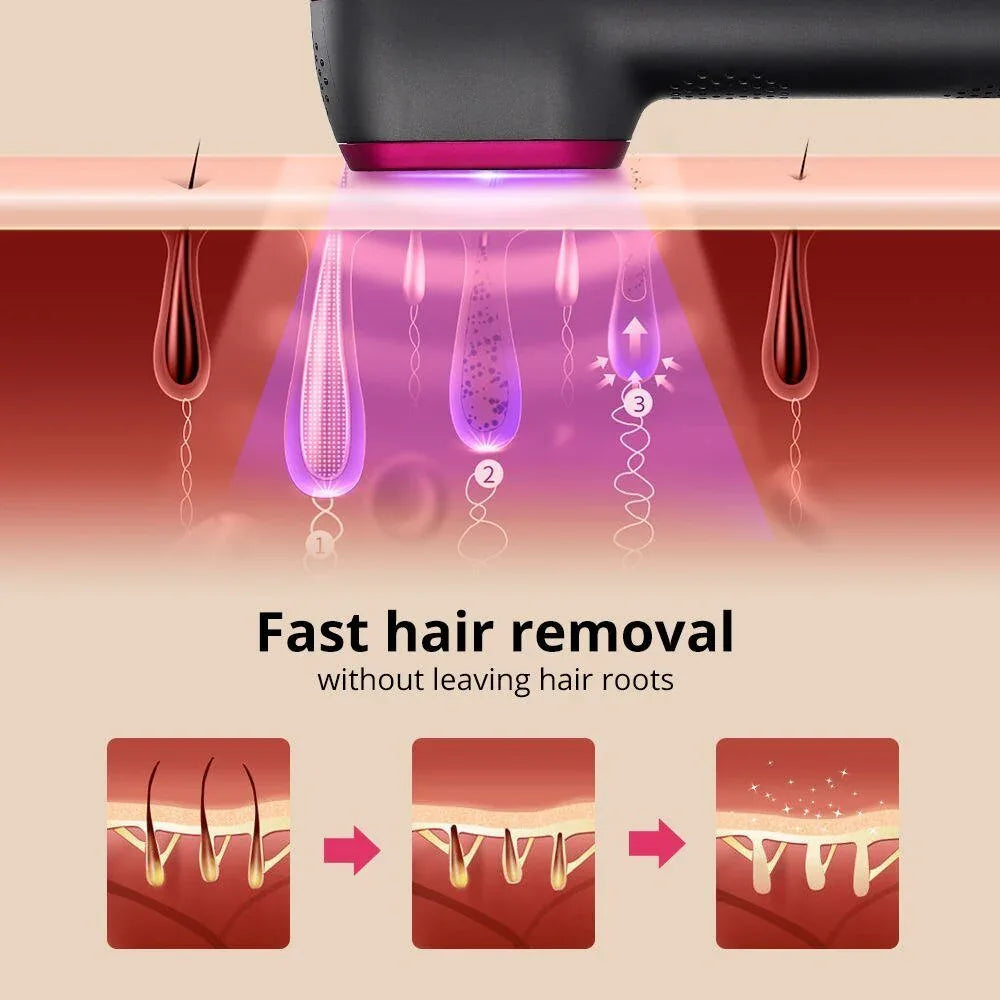 10 0000 Flashes IPL Hair Removal Device For Home 5-speed Pulse Light Painless Laser Hair Removal Device